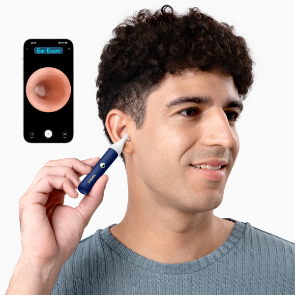Bebird EarSight Plus Otoscope with Ear Clea... | Klikk Malta