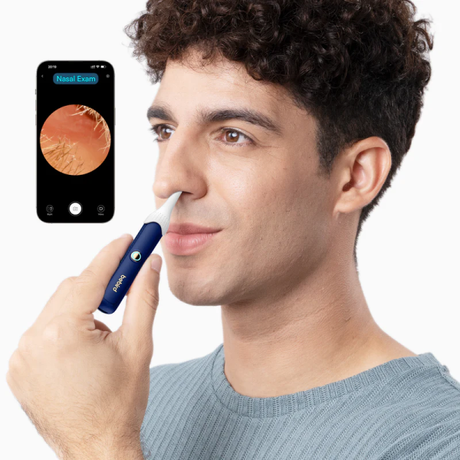 Bebird EarSight Plus Otoscope with Ear Clea... | Klikk Malta