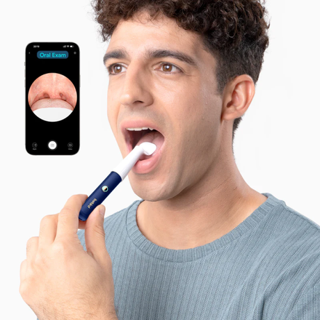 Bebird EarSight Plus Otoscope with Ear Clea... | Klikk Malta