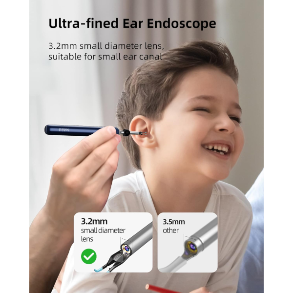 Bebird Note 5 Pro Otoscope with Ear Cleanin... | Klikk Malta